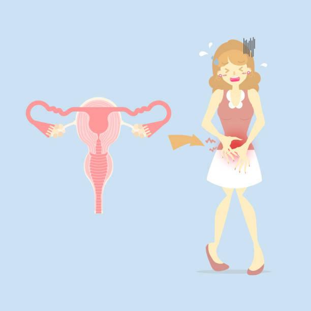 Miomas: Sinais de alerta