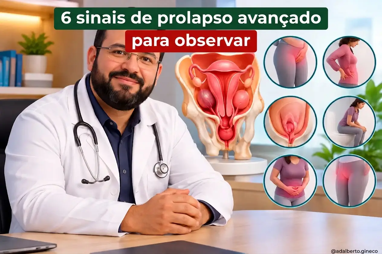 6 sinais de prolapso avançado para observar